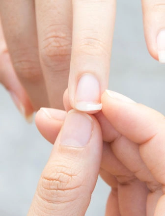 Ongles fragiles